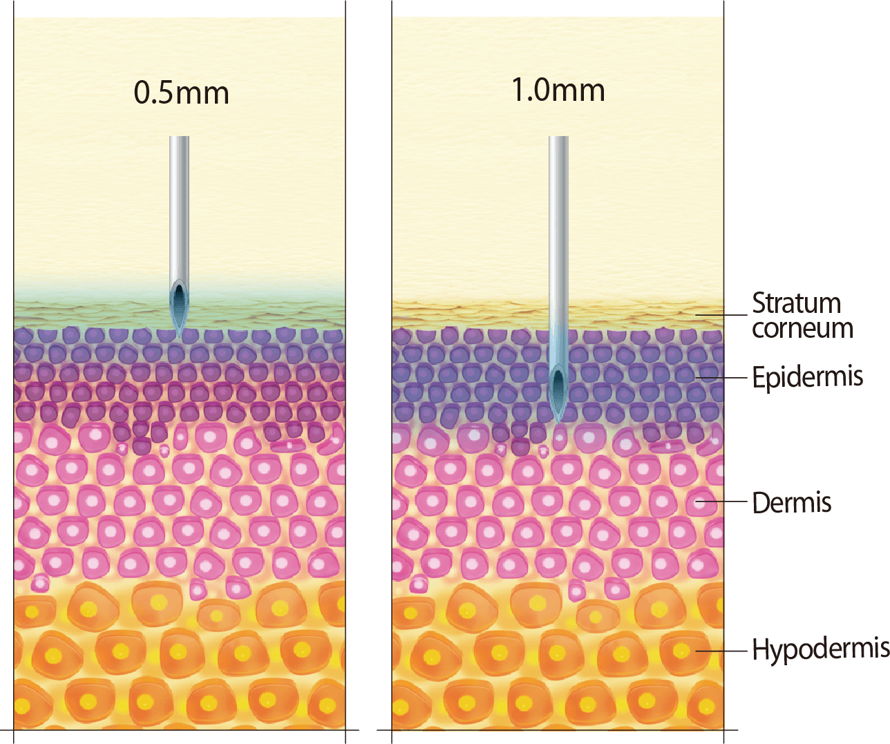 The PINK-AGING Treatment HL - 구버전 - RIBESKIN