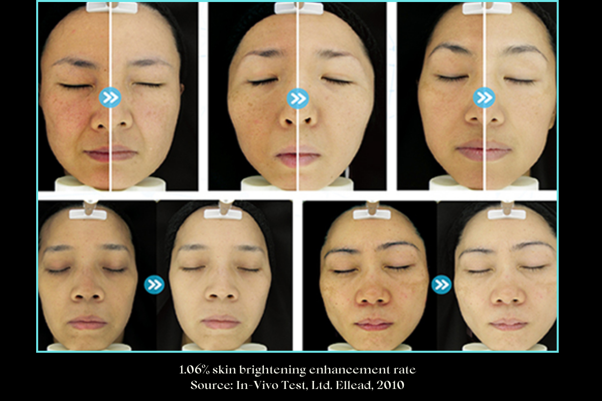 Data from In-Vivo Test, Ltd. Ellead, 2010 showcasing skin brightening enhancement rate after using RIBESKIN CO2 Carboxy Therapy