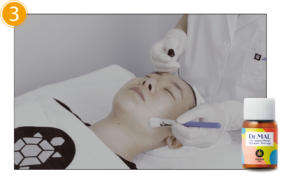 application of dr mal solution before performing pdt treatment for acne relief