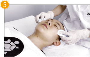 removal of dr mal solution used during pdt treatment for acne treatment