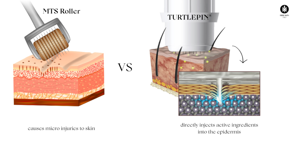 difference between microneedling using MTS roller and multi needling using turtlepin