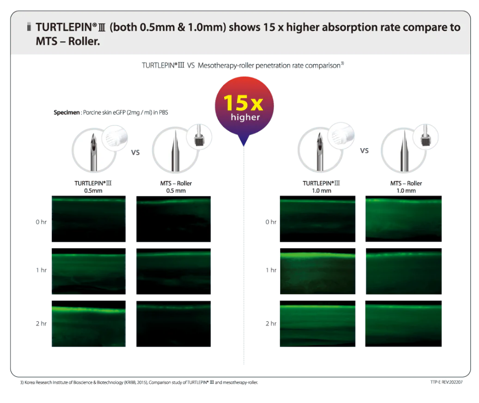 Clinical comparison data between TURTLEPIN®Ⅲ and mesotherapy rollers
