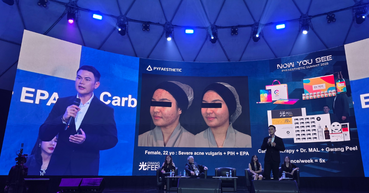 RIBESKIN GWANG PEEL lecture by Dr Hari Darmawan at PYFAESTHETIC SUMMIT 2025 in Jakarta, Indonesia