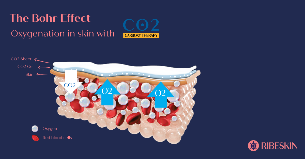Visual graphic of Bohr Effect, the principle behind RIBESKIN CO2 Carboxy Therapy aiding skin rejuvenation